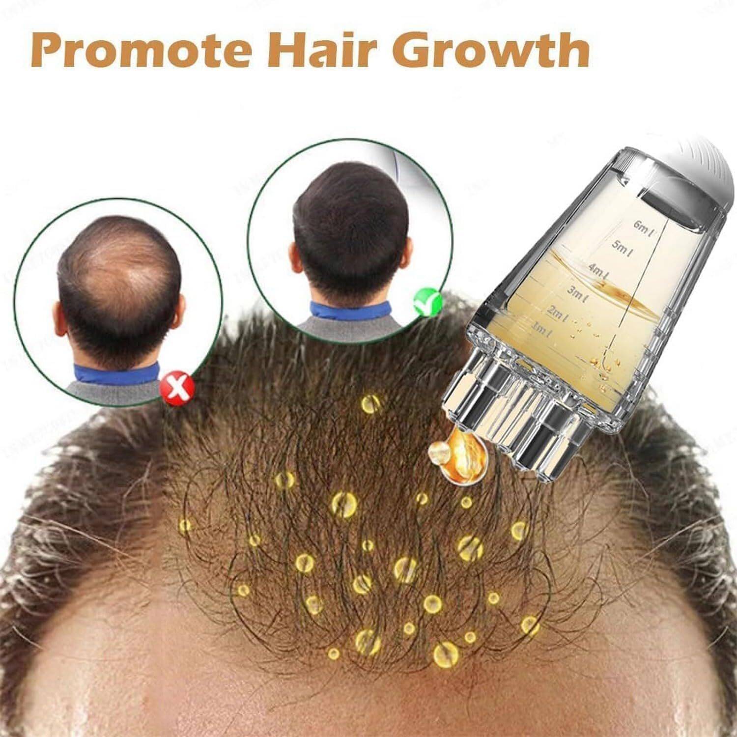Hellyz Oil Applicator Bottle For Scalp - Image 3