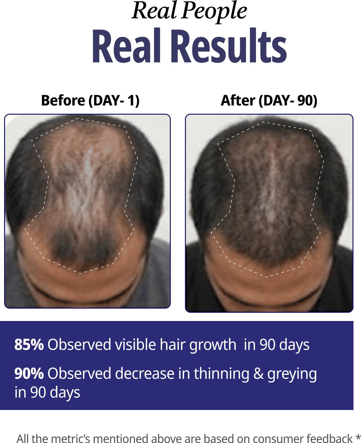 Athena- All in one Hair Serum Hair Fall Control & Follicle Boost ... more — Flash AI Score 87/100