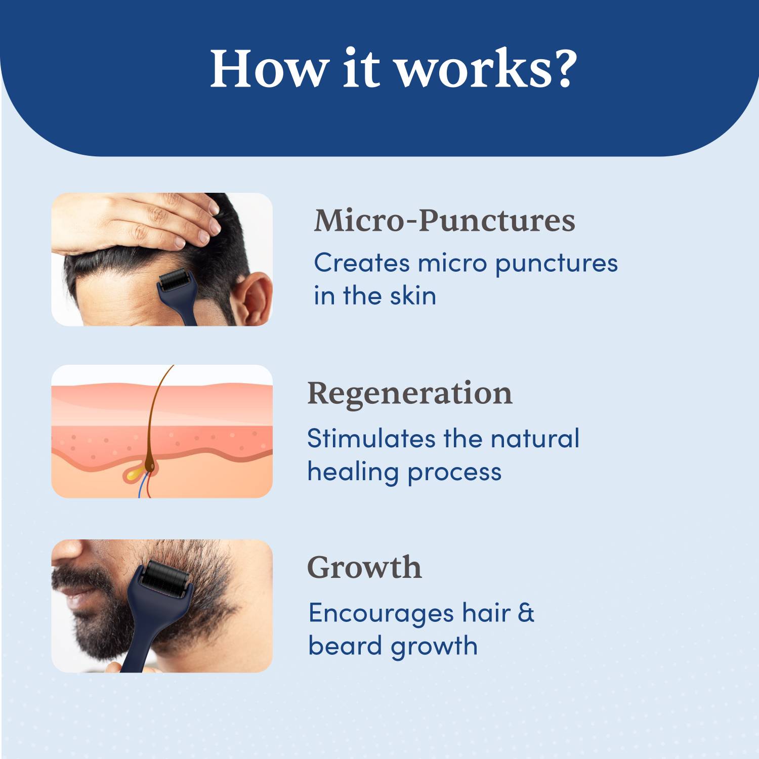 Man Matters Advance Derma Roller 540 Micro 0.5mm - Image 4