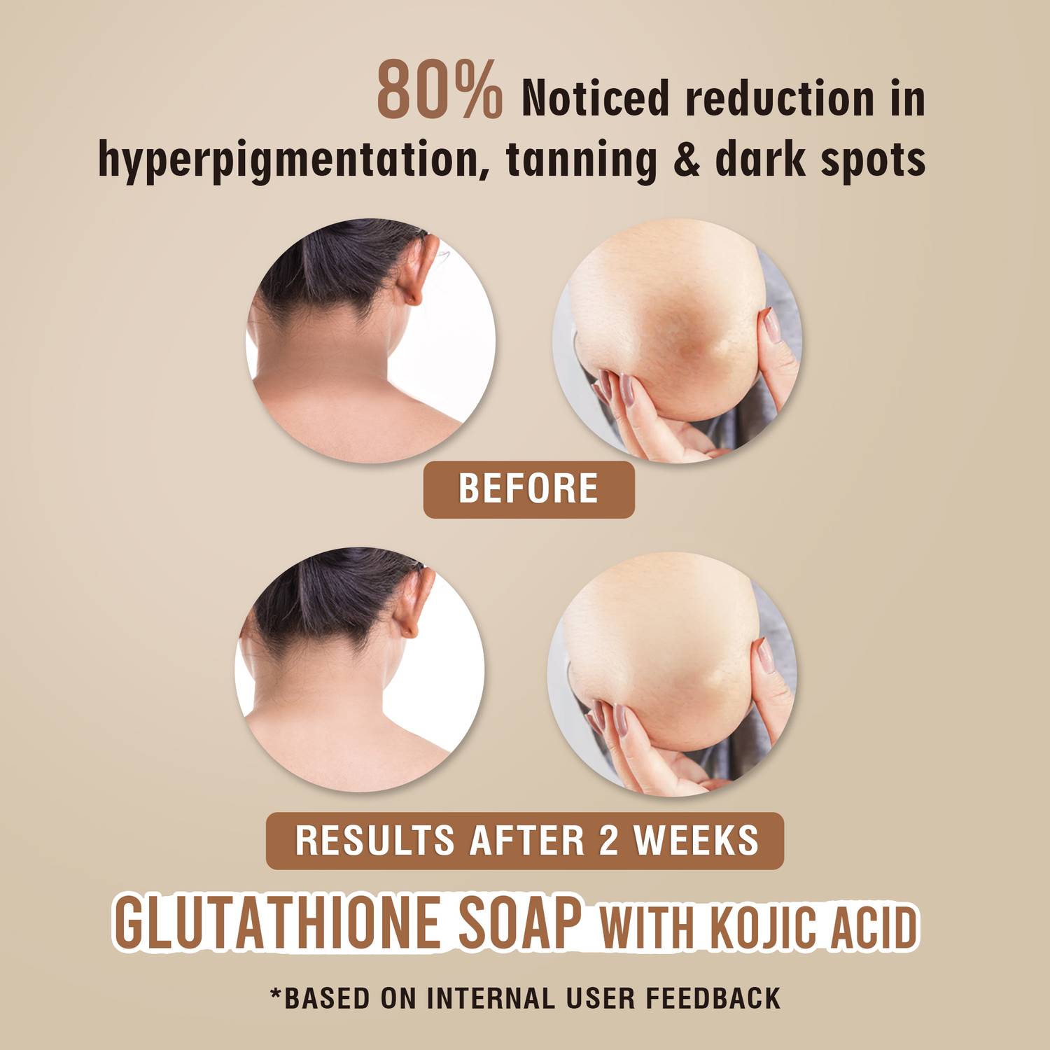 zeeglow max kojic acid and glutathione soap ZEE LAB Zeeglow Max Kojic Acid, Vit E & Glutathione Soap 75g | Remove Tan &  Pigmentation main image 0