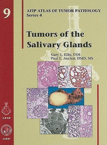 Tumors of the Salivary Glands: Buy Tumors of the Salivary Glands