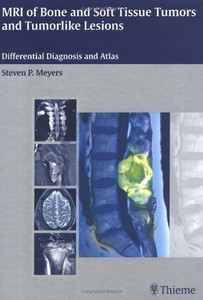 MRI of Bone and Soft Tissue Tumors and Tumorlike Lesions: Buy MRI of ...
