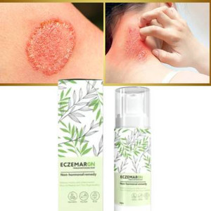 LootZoo Eczemaron Anti Fungal Cream for Fungal Skin Infections ...
