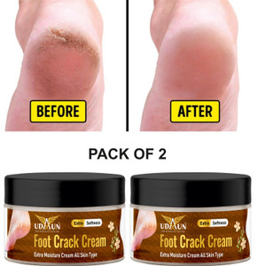 Udaun Feet Up Advanced Cracked Heel Repair Smooth Foot Cream (50