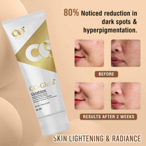 glutathione peroxidase thyroid gland The glutathione peroxidase reaction. a The catalytic triad that is