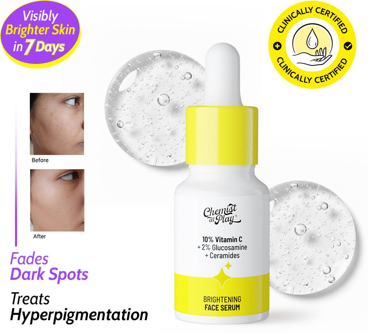 Chemist at Play 10% Vitamin C Serum - Face Serum for Women & Men - Brightens & Gives Glow