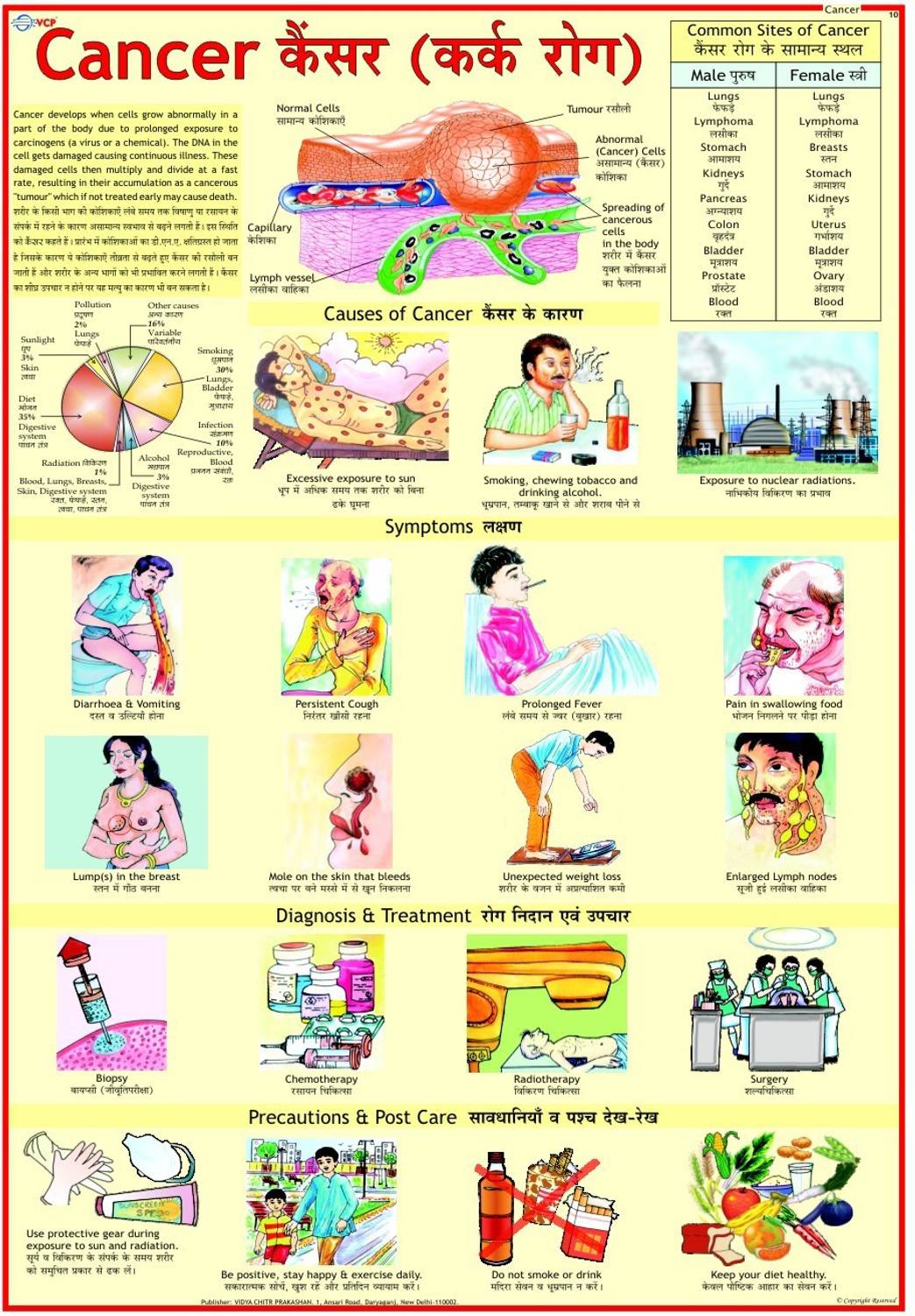 Cancer Chart Photographic Paper