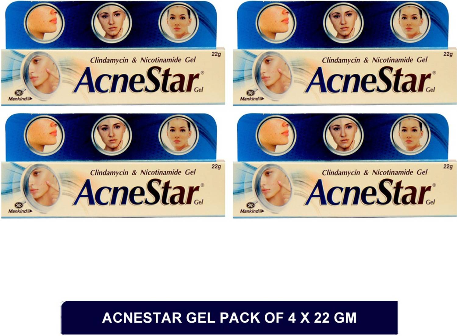 Acnestar gel | Best Gel to Remove Acne(pack of 4) Gel