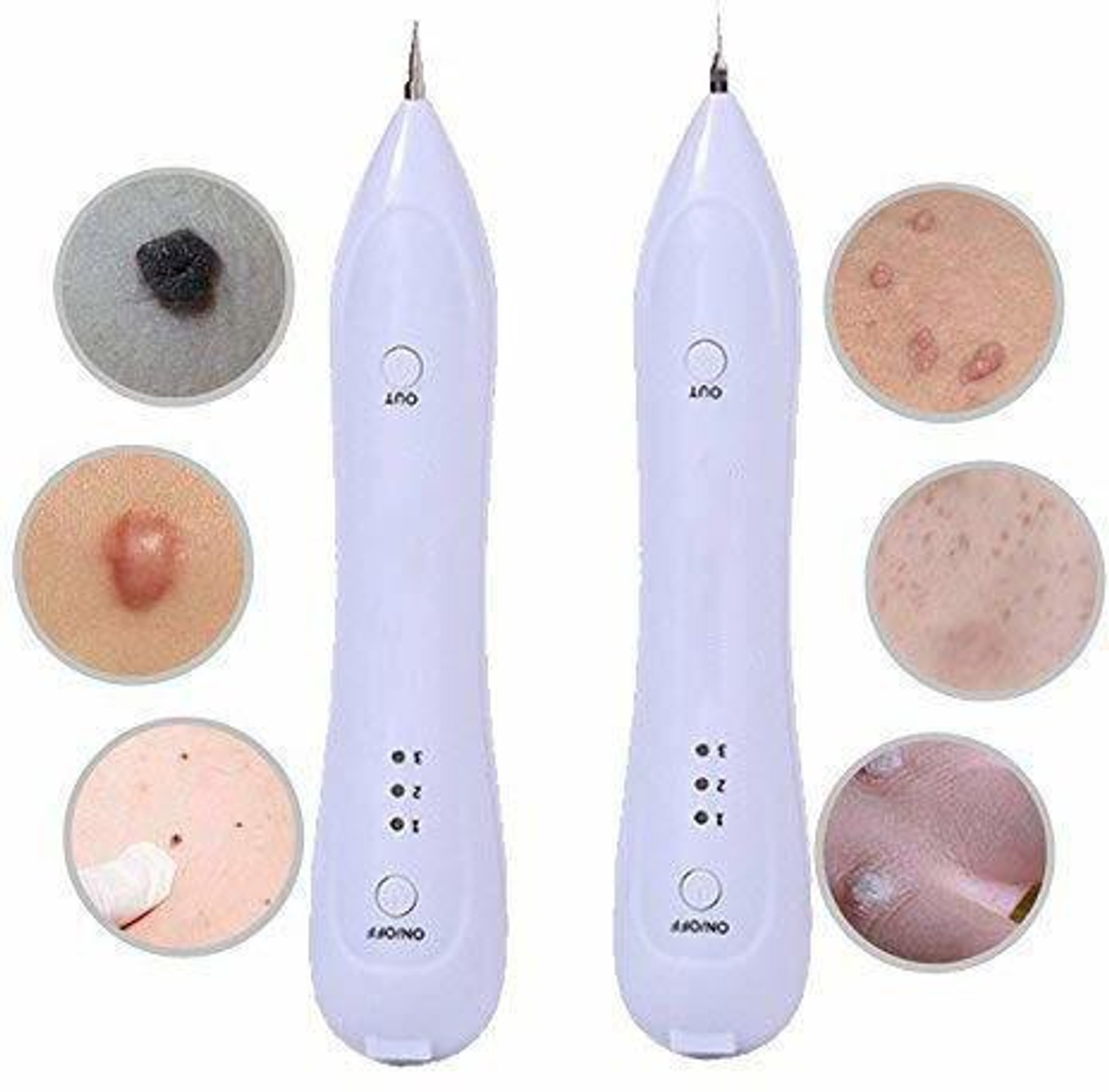 Image of Kostech Electric Freckle Skin Tag Remover Mole Dark Spot Remover Pen Warts Speckle Mucus Removal Device