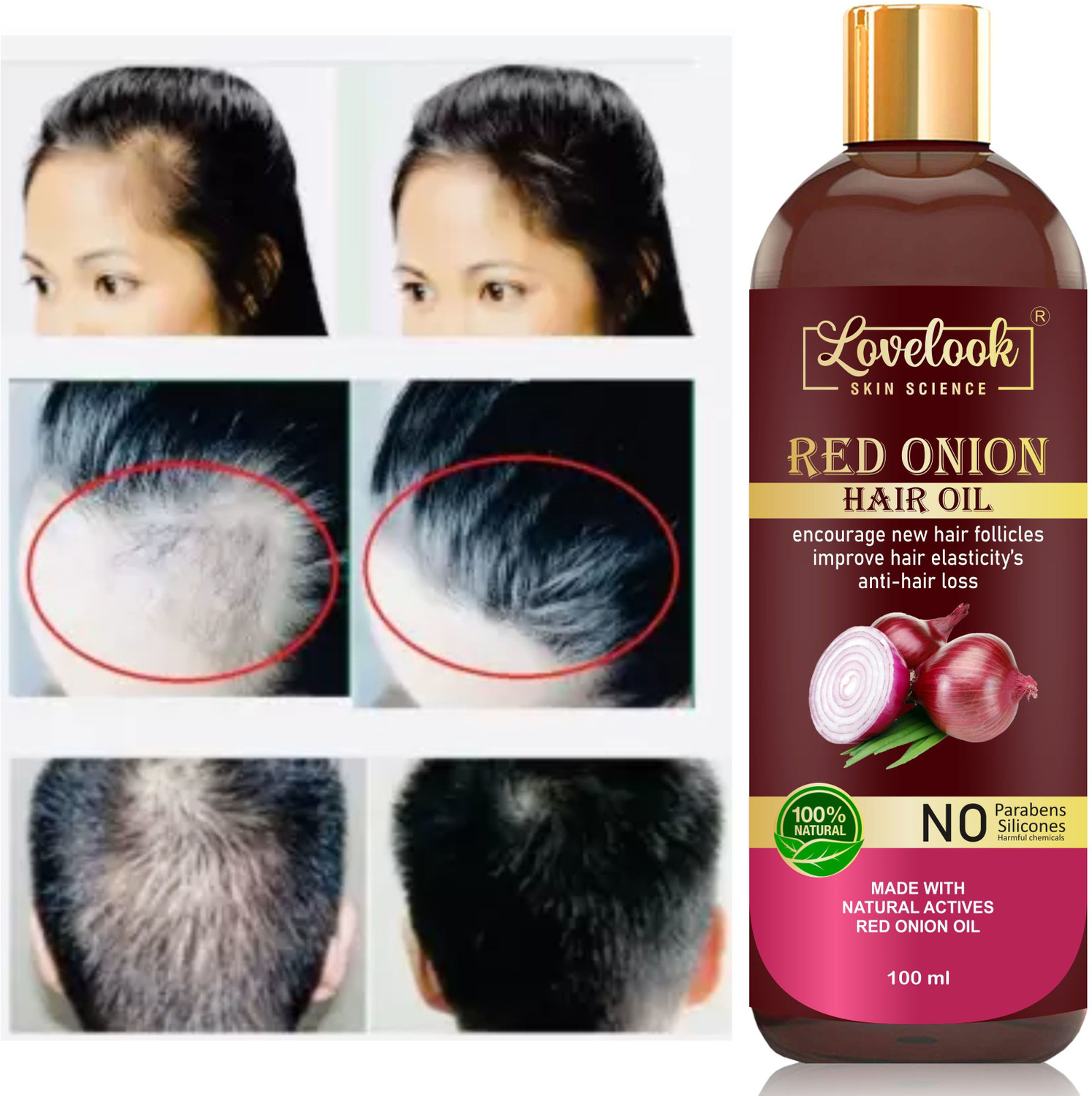 Image of Lovelook Onion Hair Oil with 14 Essential Oils for Hair Regrowth, Dandruff Control Hair Oil