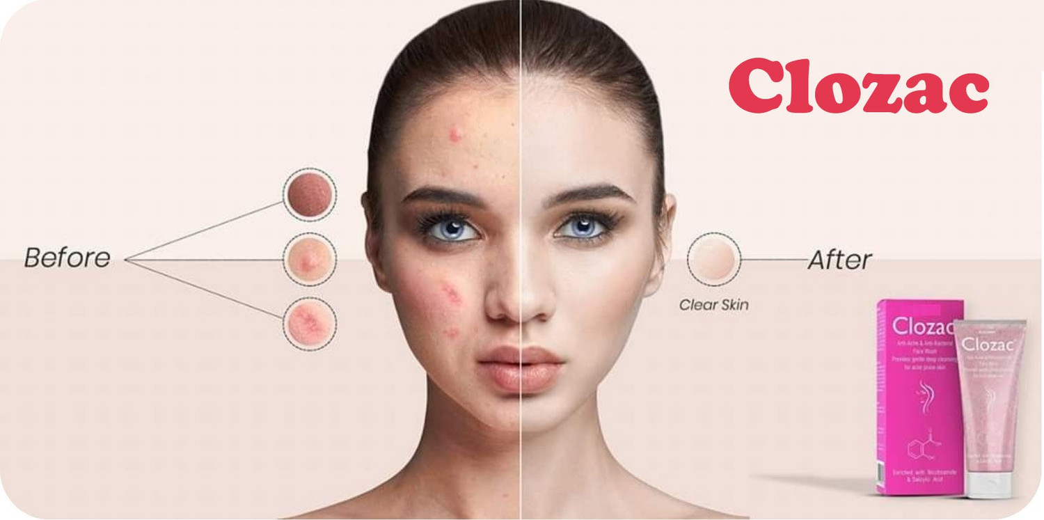 Image of clozac Fairness Facewash Cleansing For Acne Prone Skin Pack of 2 Face Wash