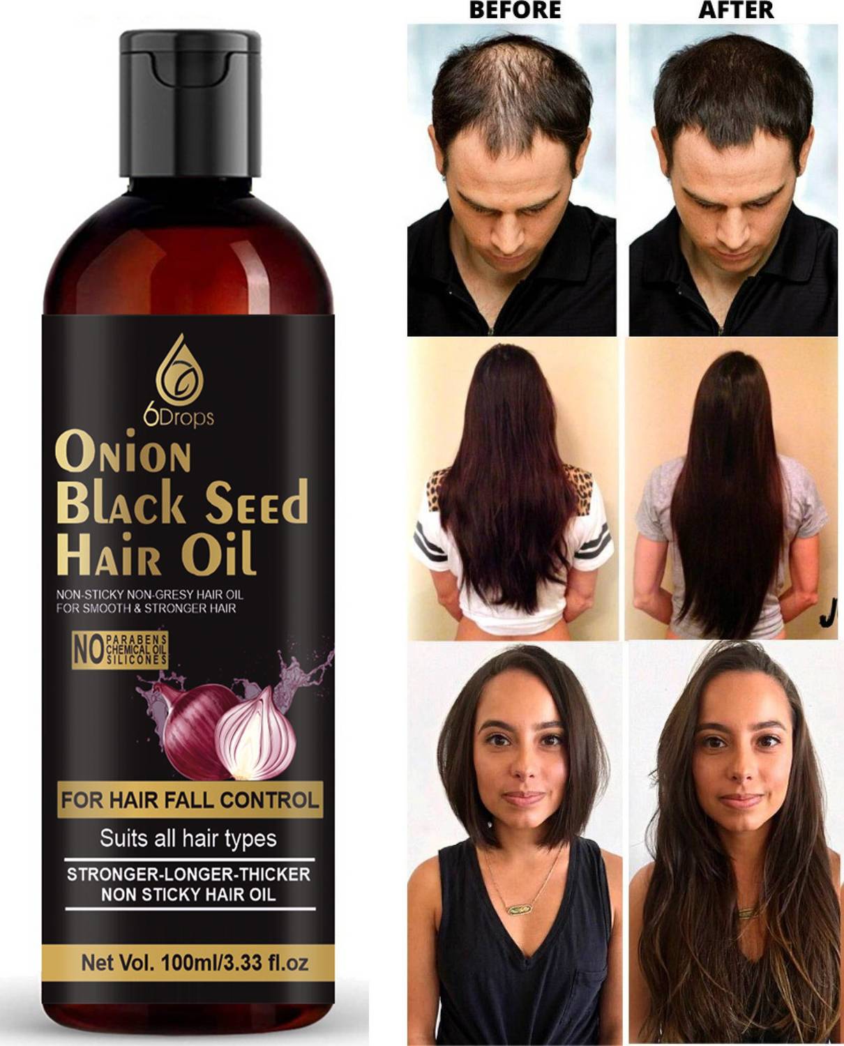 6Drops Onion Black Seed oil For Hair Fall Control, Hair Regrowth Hair Oil