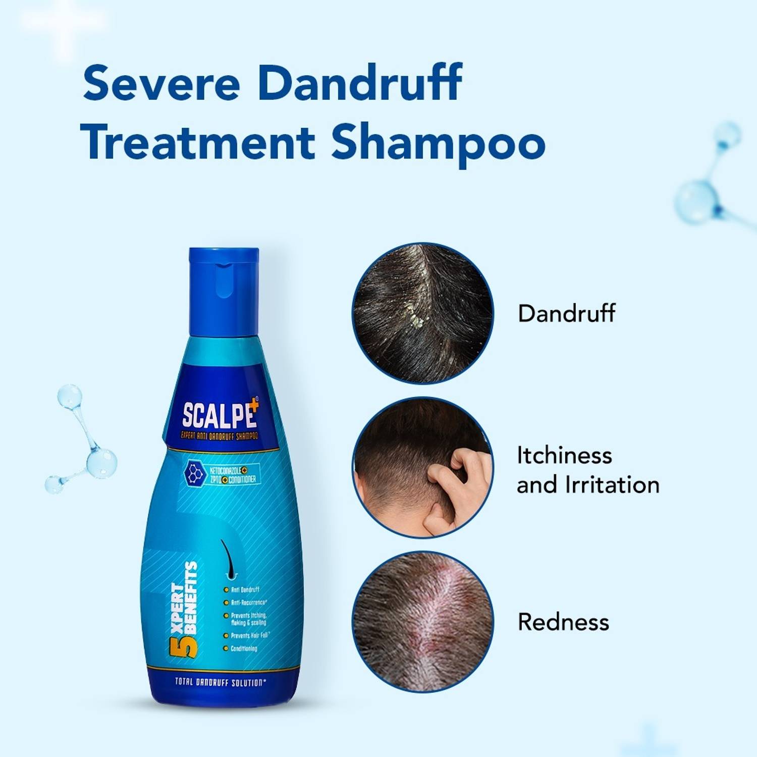 Scalpe Plus Anti Dandruff Shampoo 75ml - Image 2