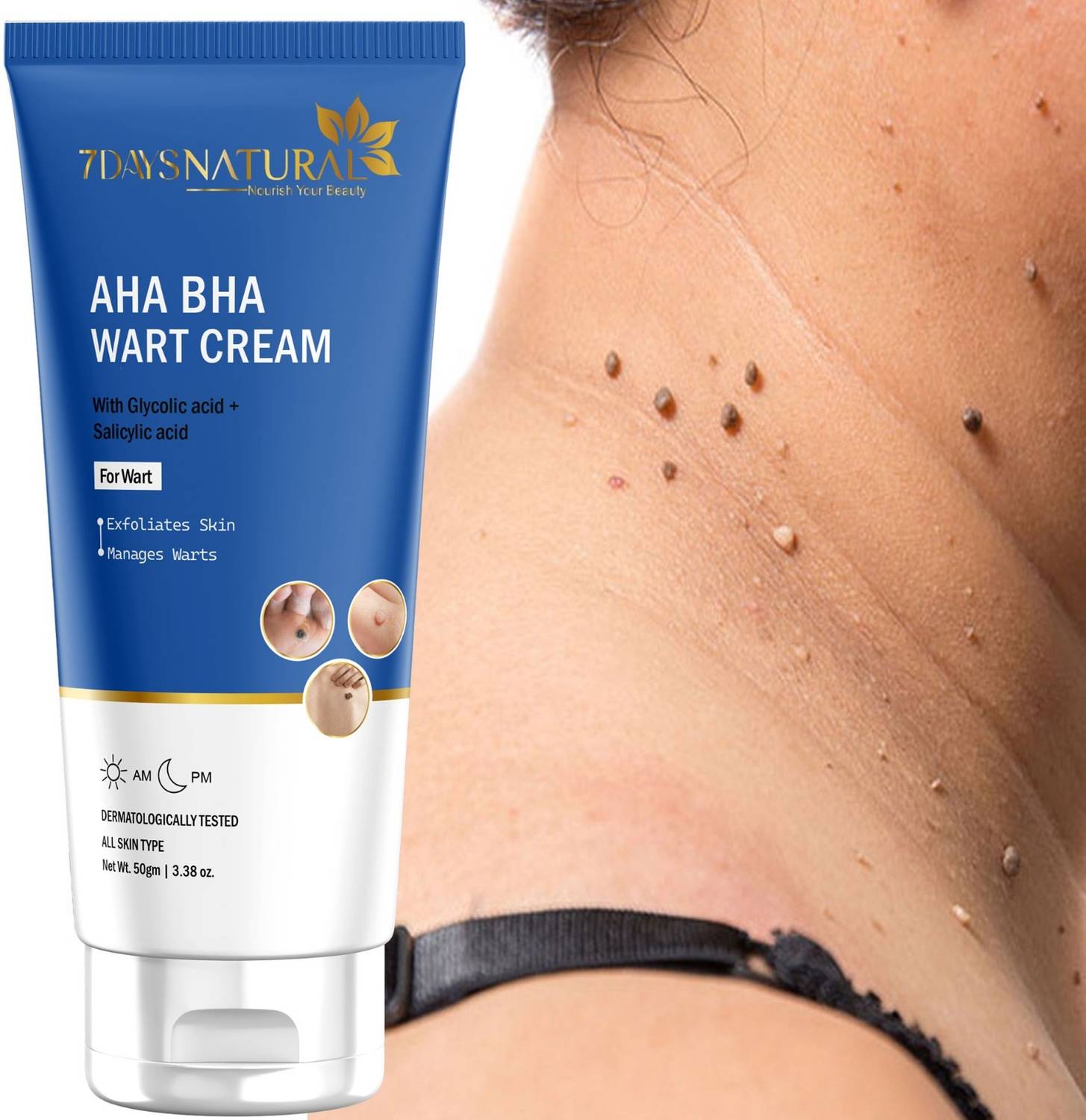 7days natural AHA BHA Wart Cream – Clears Skin Naturally – 50g Pack Of 1