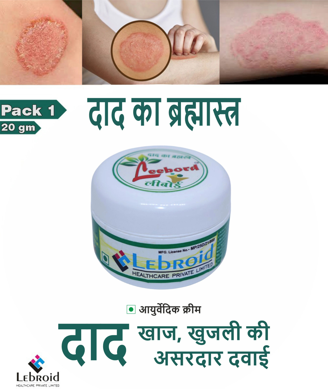 Image of leebord Cream for Ringworm