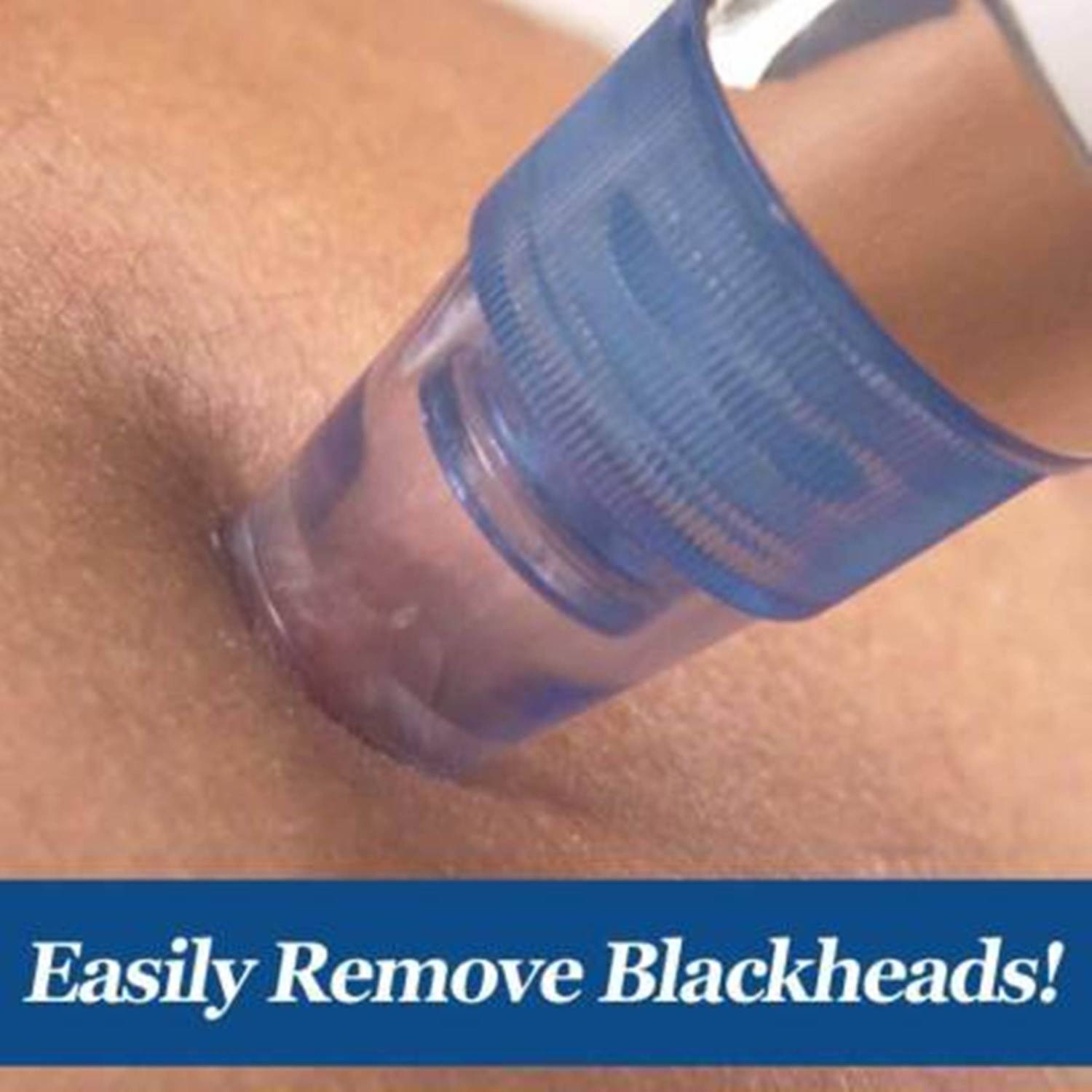 Ukarto Blackhead Remover Vacuum Suction Device Pack of 4 - Image 2