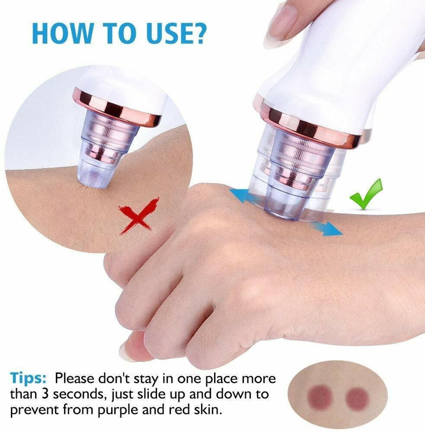 Image of ClothyDeal Plastic, Fiber Blackhead Remover Vacuum Suction Device