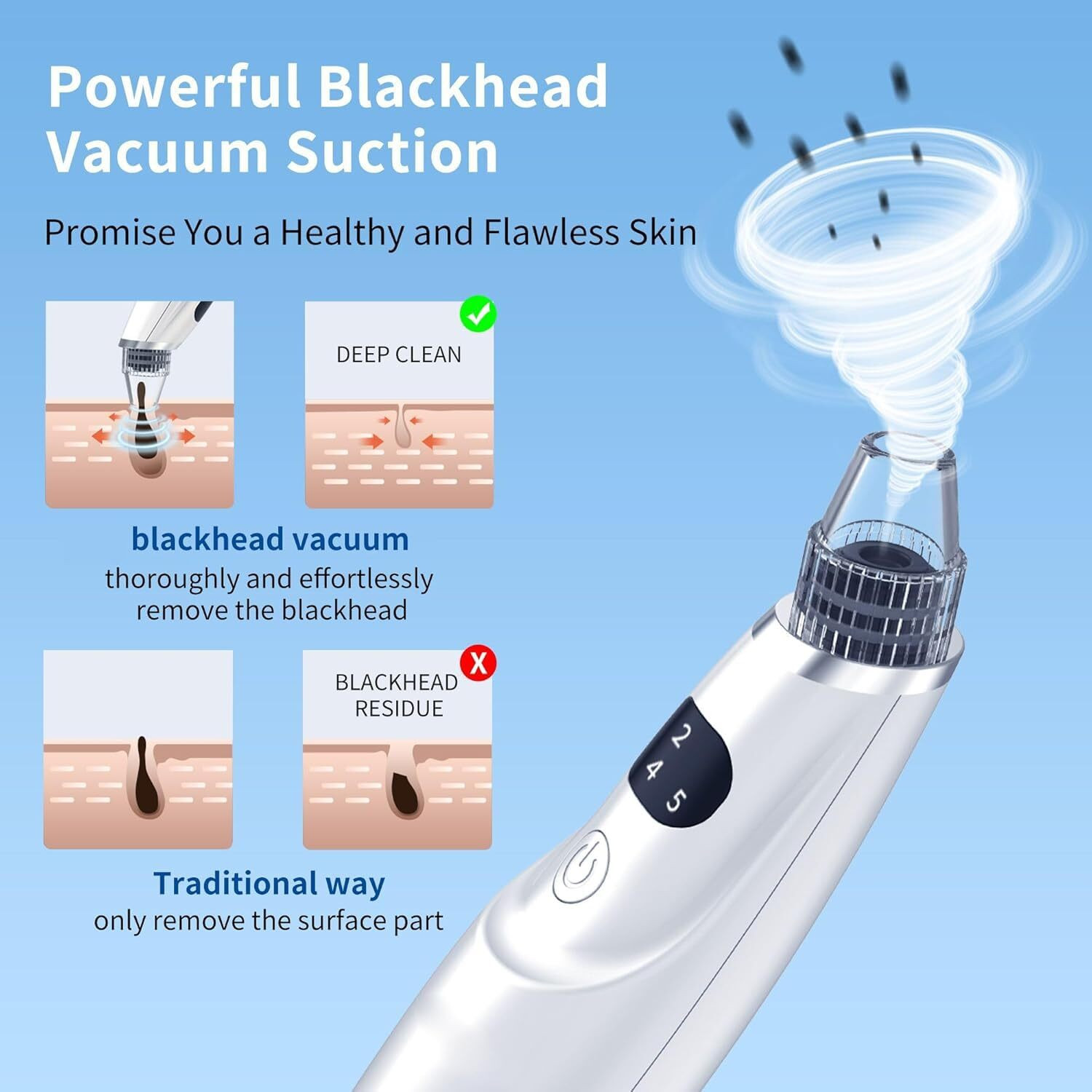Image of DOCOSS Polymer Blackhead Remover Vacuum Suction Device