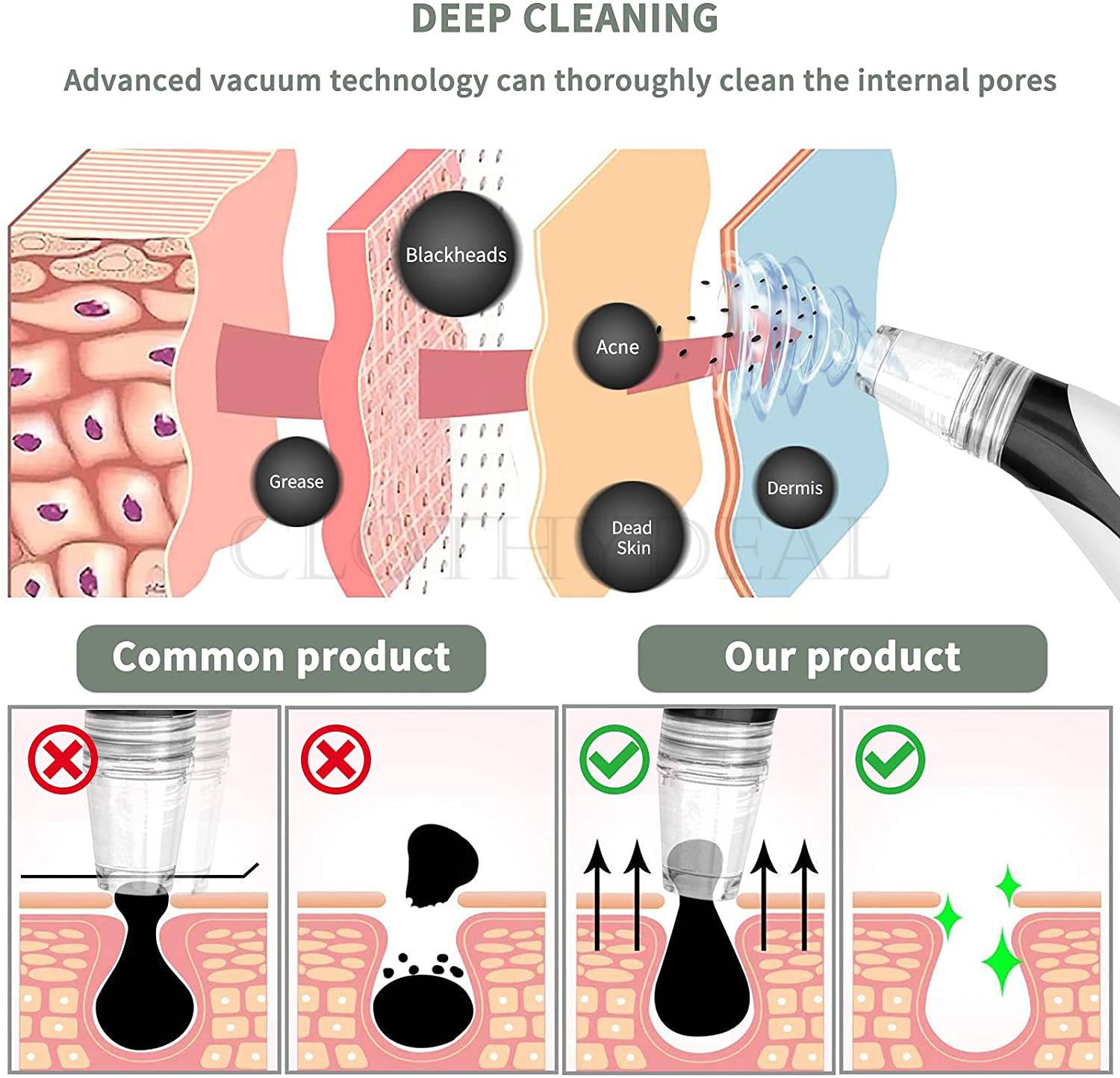 ClothyDeal Blackhead Remover Vacuum Suction Device - Image 3