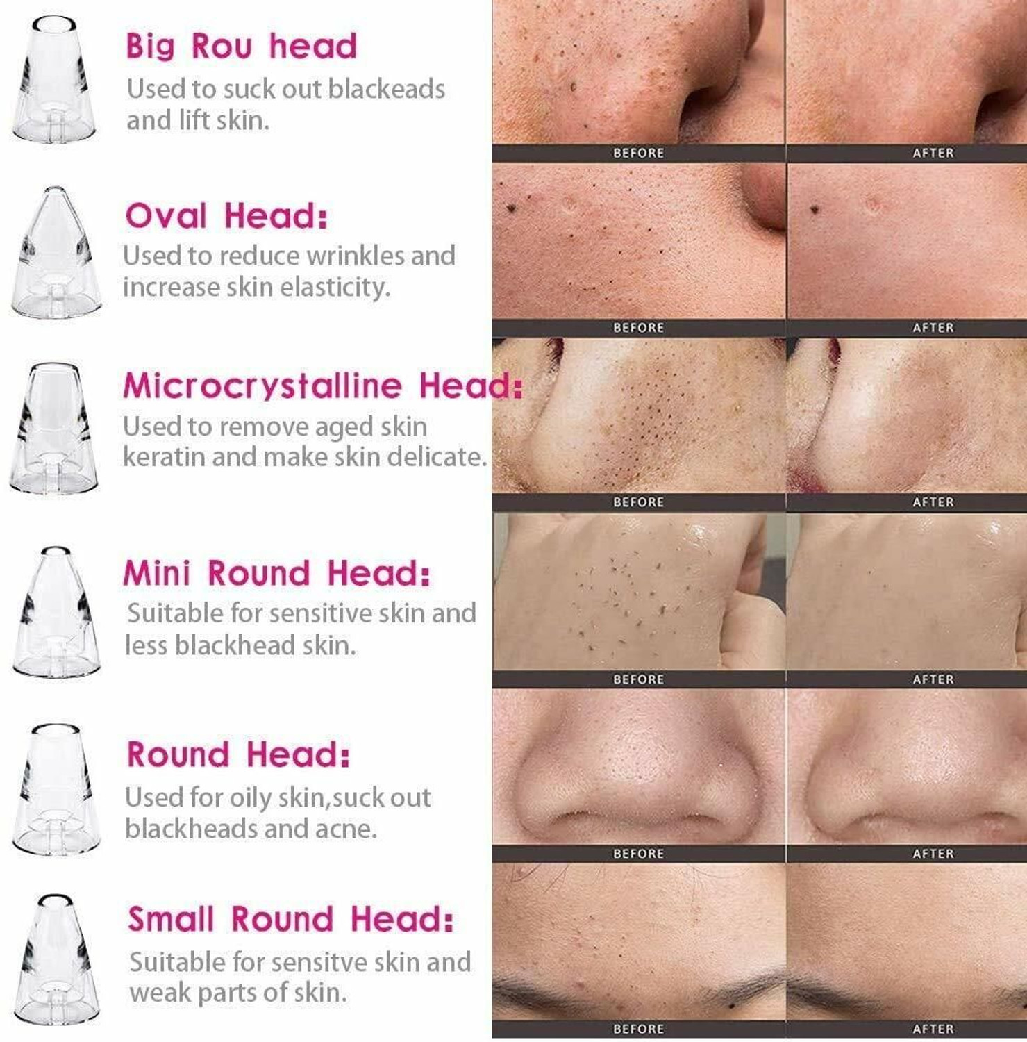 Image of ClothyDeal Plastic, Fiber Blackhead Remover Vacuum Suction Device