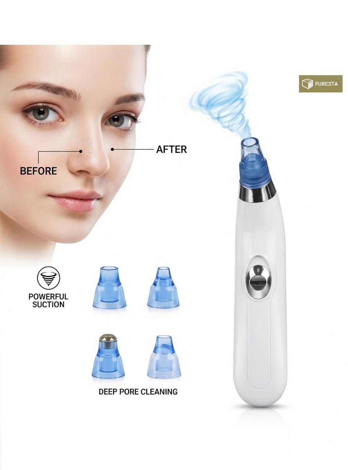 FURESTA Blackhead Remover Vacuum Suction Device - Image 1