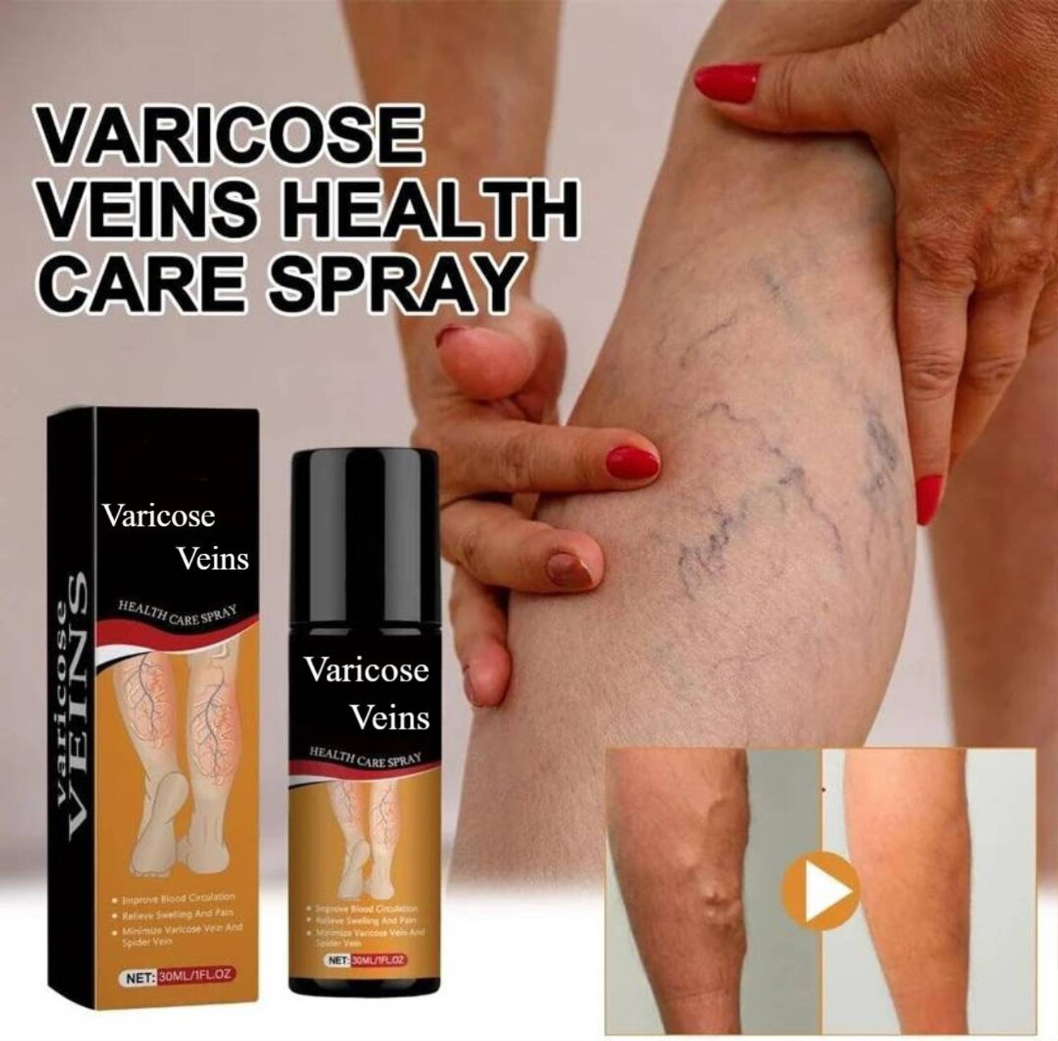 AOBENZ Varicose Veins Spray - Herbal Relief Reduces Swelling, Relieves Pain Spray Spray
