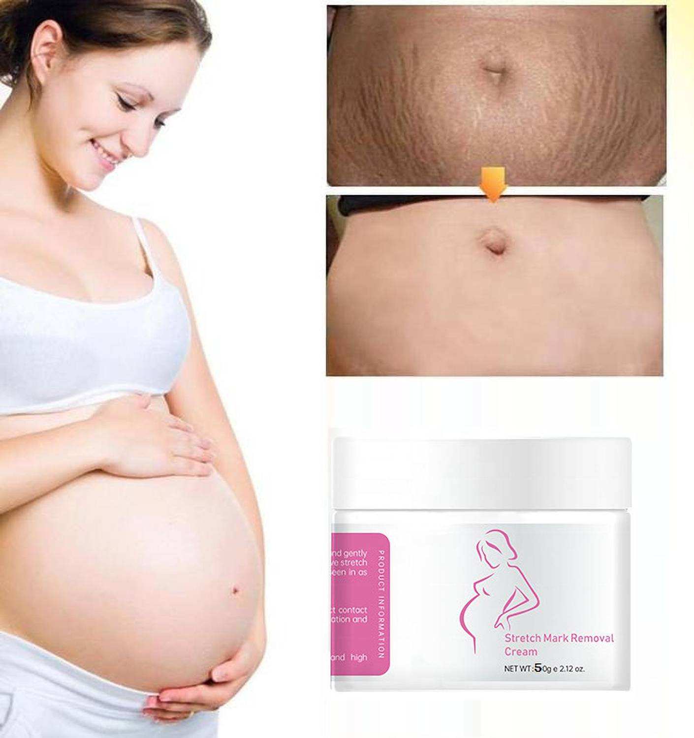 ADJD Marks Cream to Reduce Stretch Marks & Scars