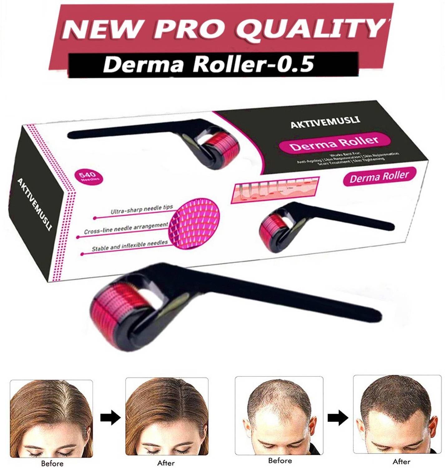 Aktivemusli Derma roller 0.5mm for hair regrowth for Beard Also Reduces Hair Fall