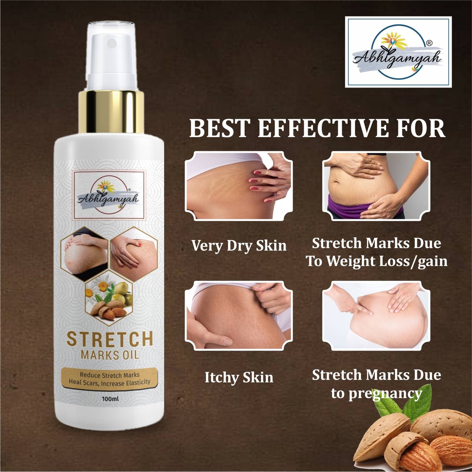 ABHIGAMYAH stretch mark removal oil men under arms stretch mark (100 ml)