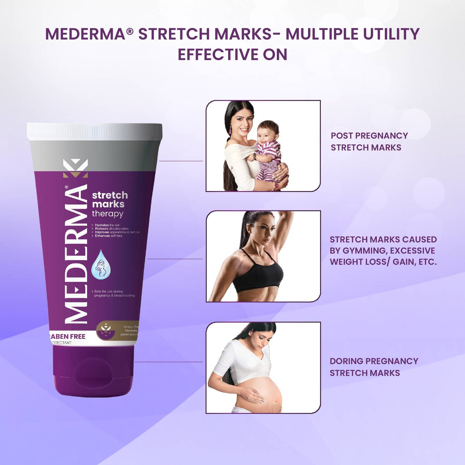 MEDERMA Stretch Mark Removal Therapy - Image 2