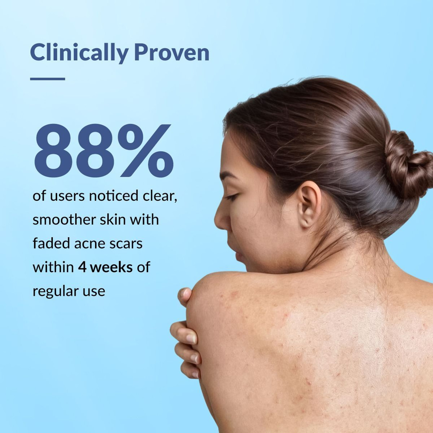 Image of Fixderma 2% Salicylic Acid Salyzap Body Wash For Body Acne, Back, Shoulders, Arms Acne