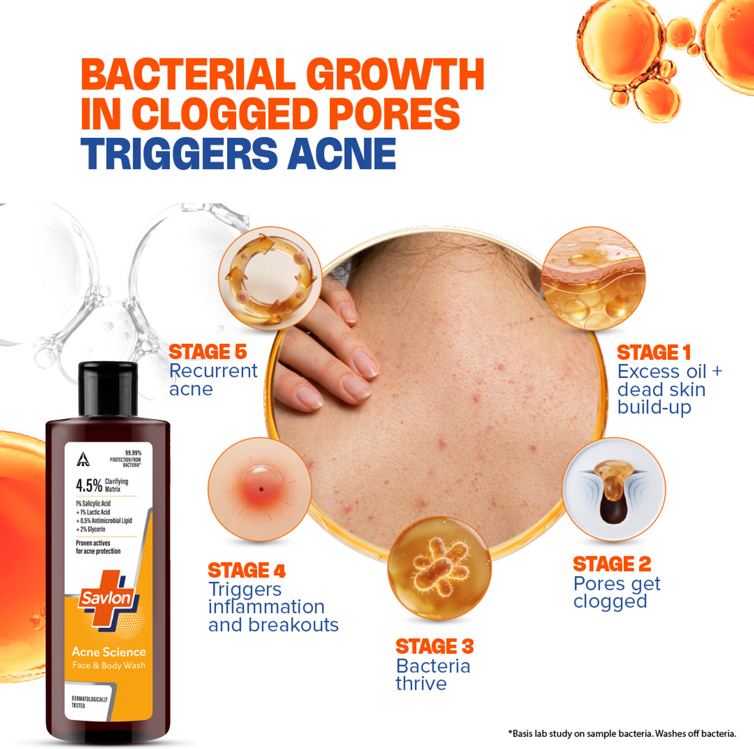 Image of Savlon Acne Science Face & Body Wash 250ml, With Salicylic & Lactic Acid, Dermat Tested