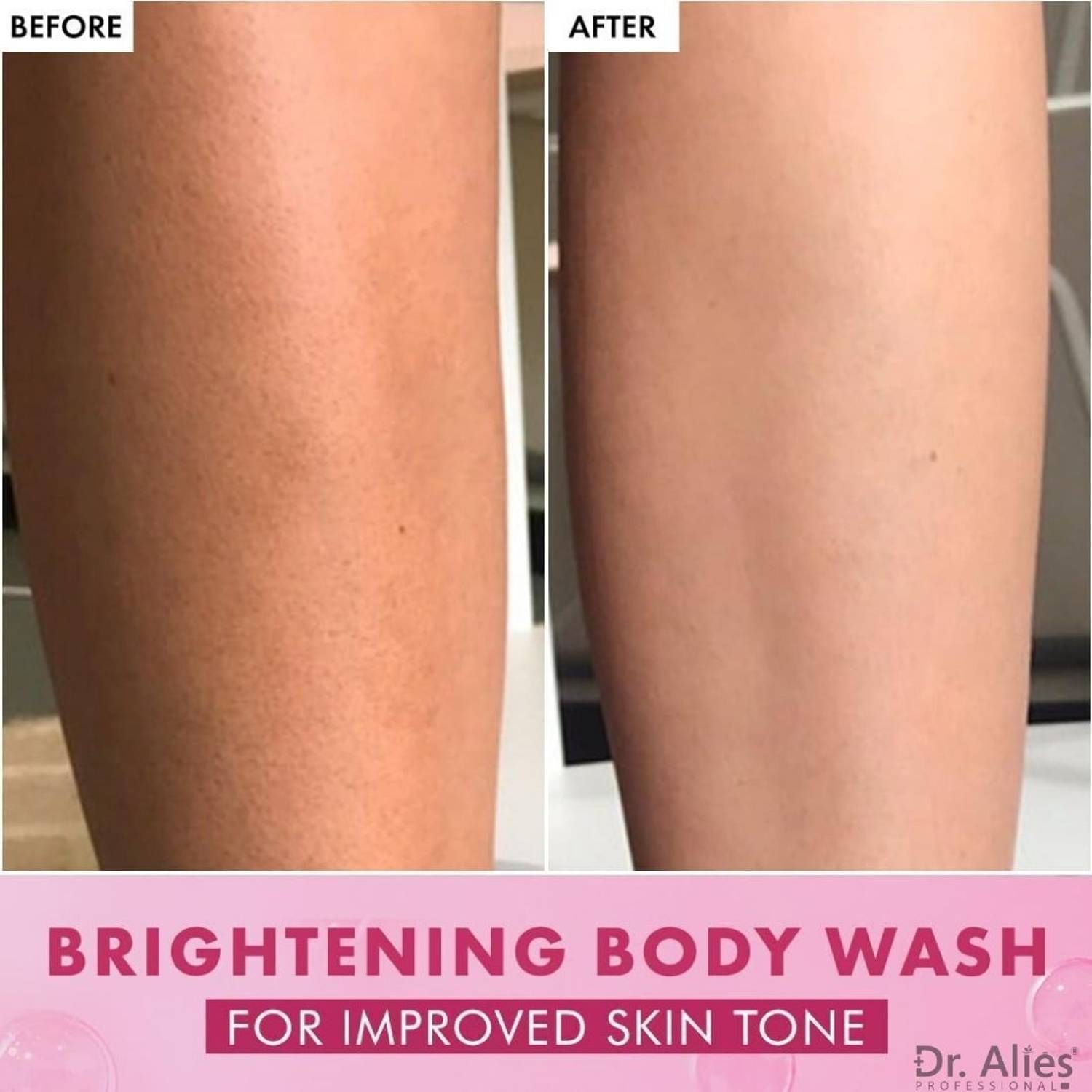 Dr. Alies Professional 7% AHA BHA Exfoliating Body Wash - Image 3