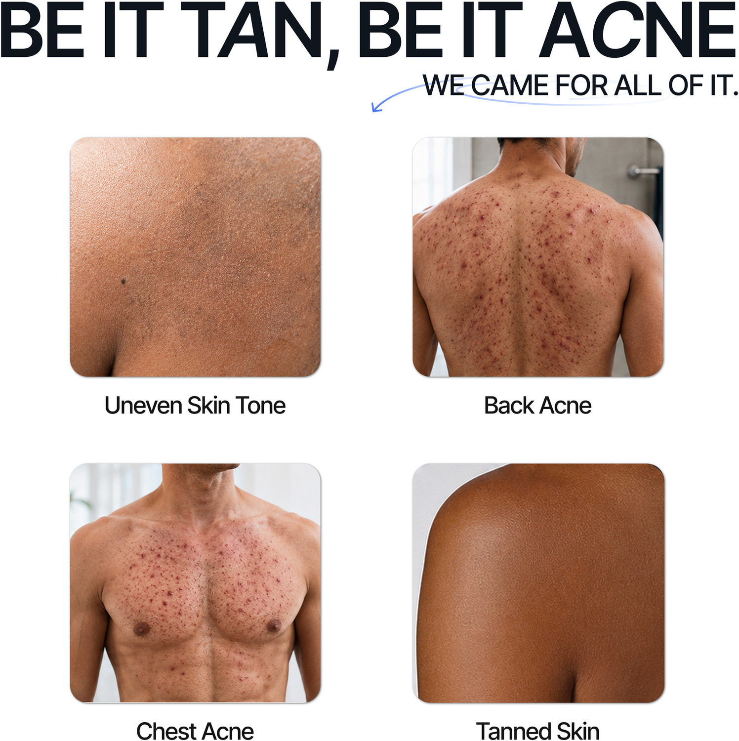 Image of Mannlich Full Body Wash Kit | De-Tan Body Wash + Bacne Body Wash + Intimate Foaming Wash | Complete Body Cleansing