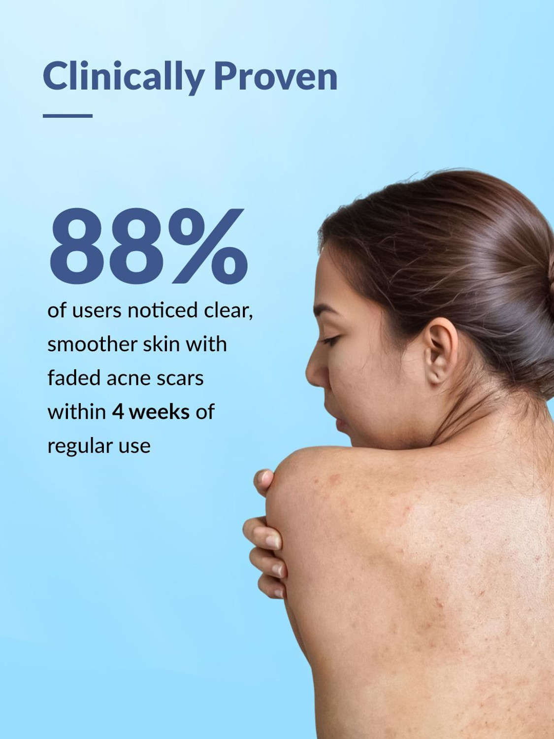 Image of Fixderma 2% Salicylic Acid Salyzap Body Wash For Body Acne, Back, Shoulders, Arms Acne