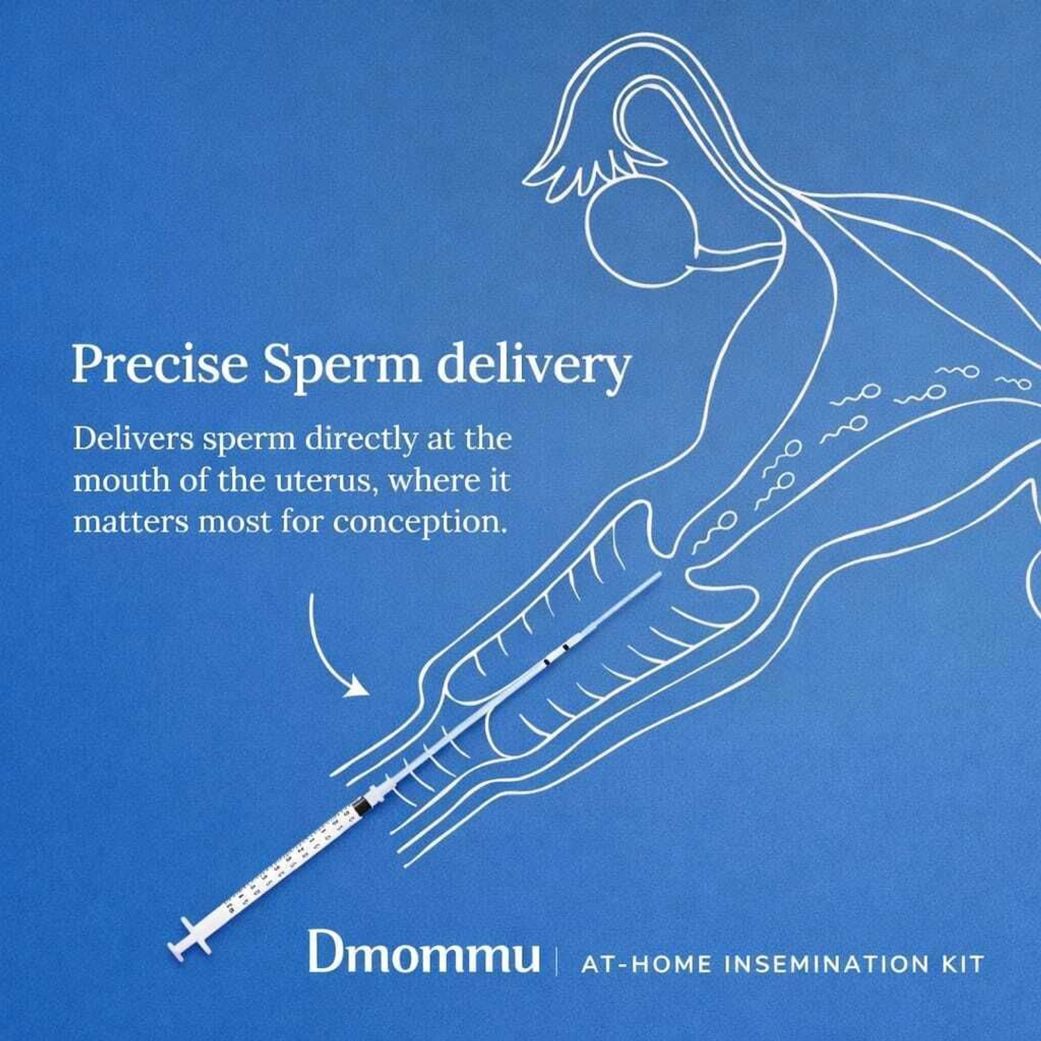 Image of Dmommu Self Insemination Kit for Women-17cm| 5 Syringes, 5 Catheters & 2 Containers Intravenous Cannula