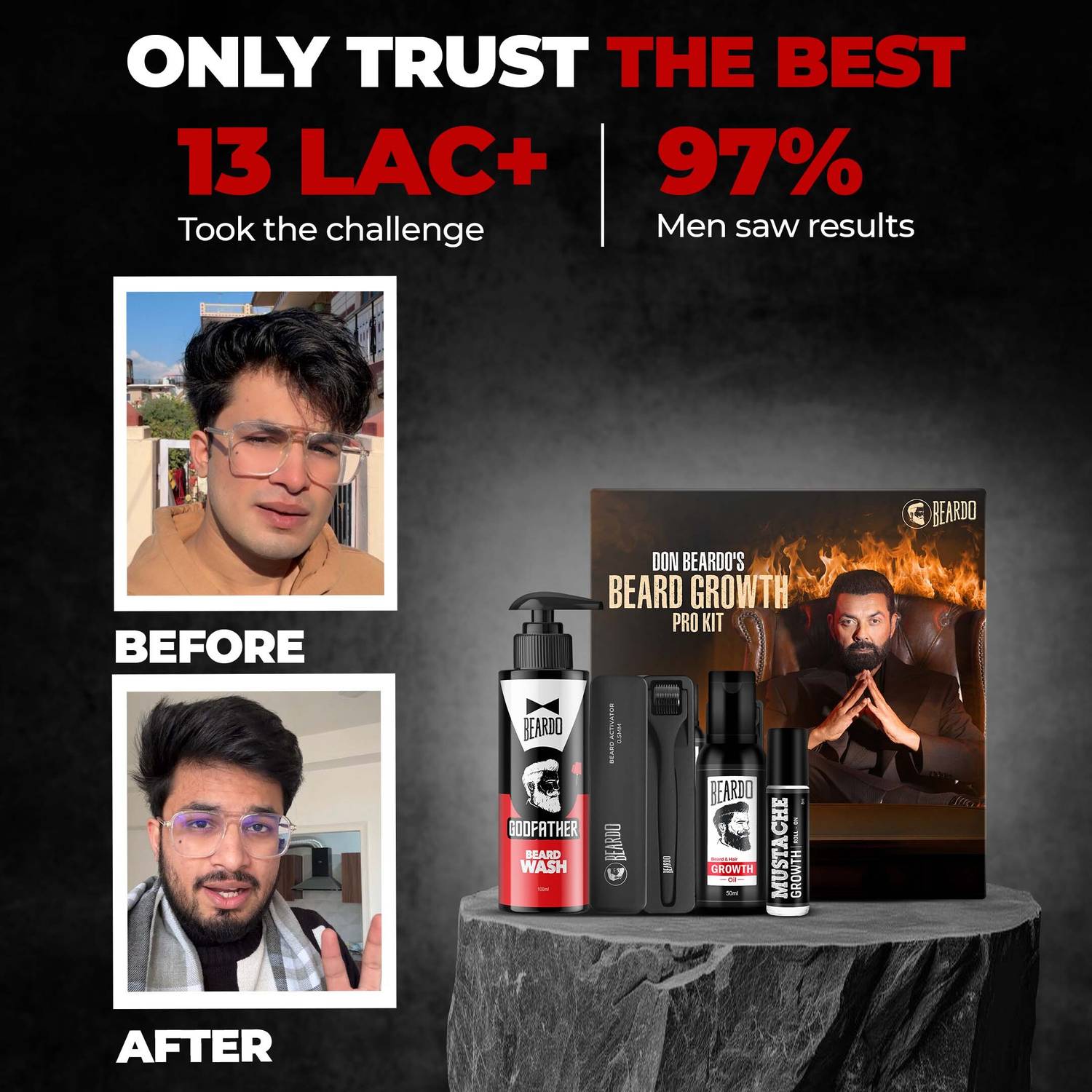 BEARDO Don Beard Growth Pro Kit - Image 4