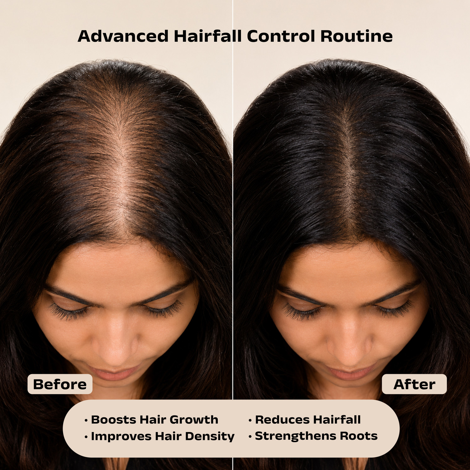 Image of veqix Jadibuti Kit with Herbs Infused Oil, Hairfall Shampoo & Hair Growth Serum (3 Items in the set)
