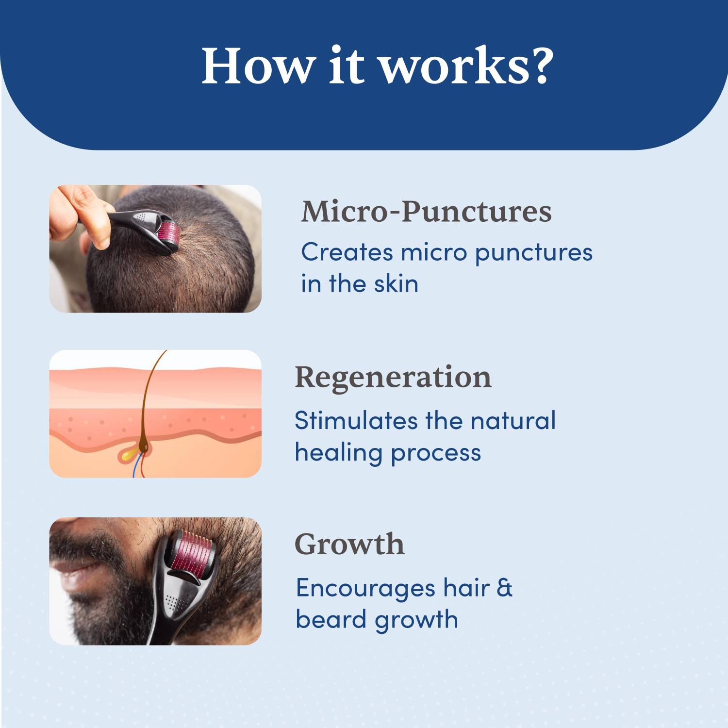 Man Matters Derma Roller 540 Micro 0.5mm Titanium Needle - Image 4