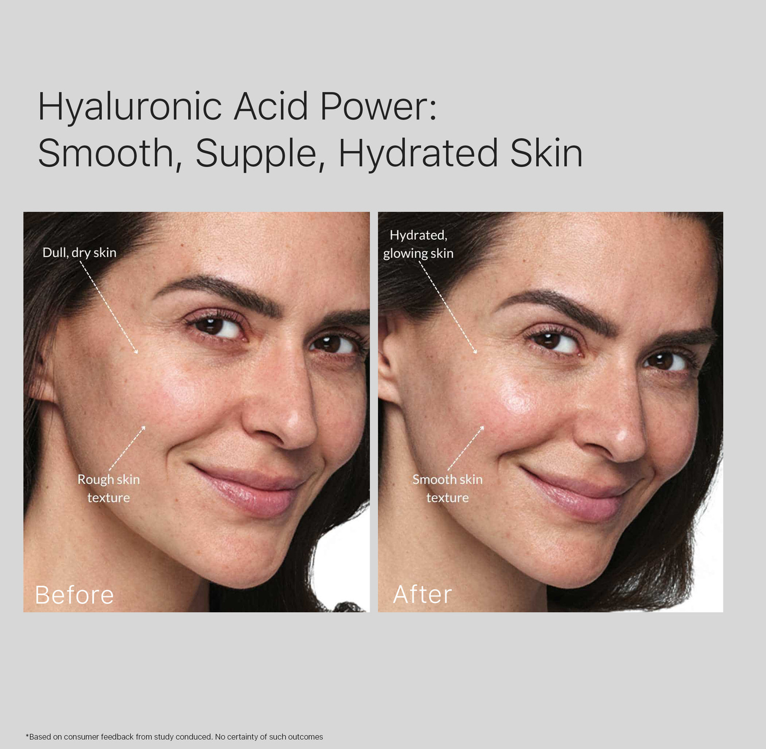 Image of Minomine Deep Moisture Repair Skincare Set | Hydrating Glow for Dry Skin | Cleanser, Serum & Moisturizer