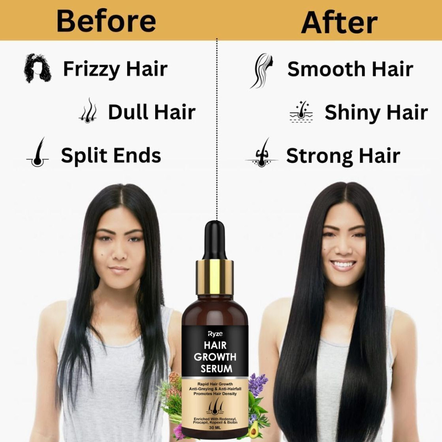 Image of Ryze Advanced Serum - Redensyl, Anagain, Biotin for Hair Growth with derma roller