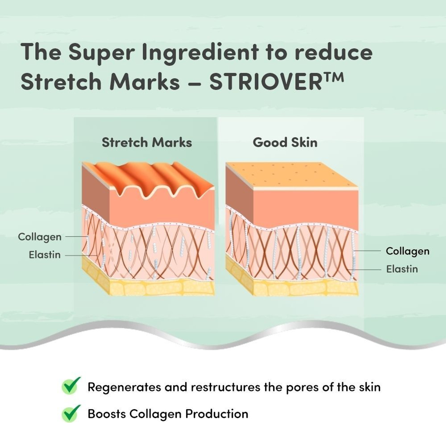Image of MYLO Care Stretch Marks Removal Combo Kit | Day and Night Care (100ml Oil+100g Cream)