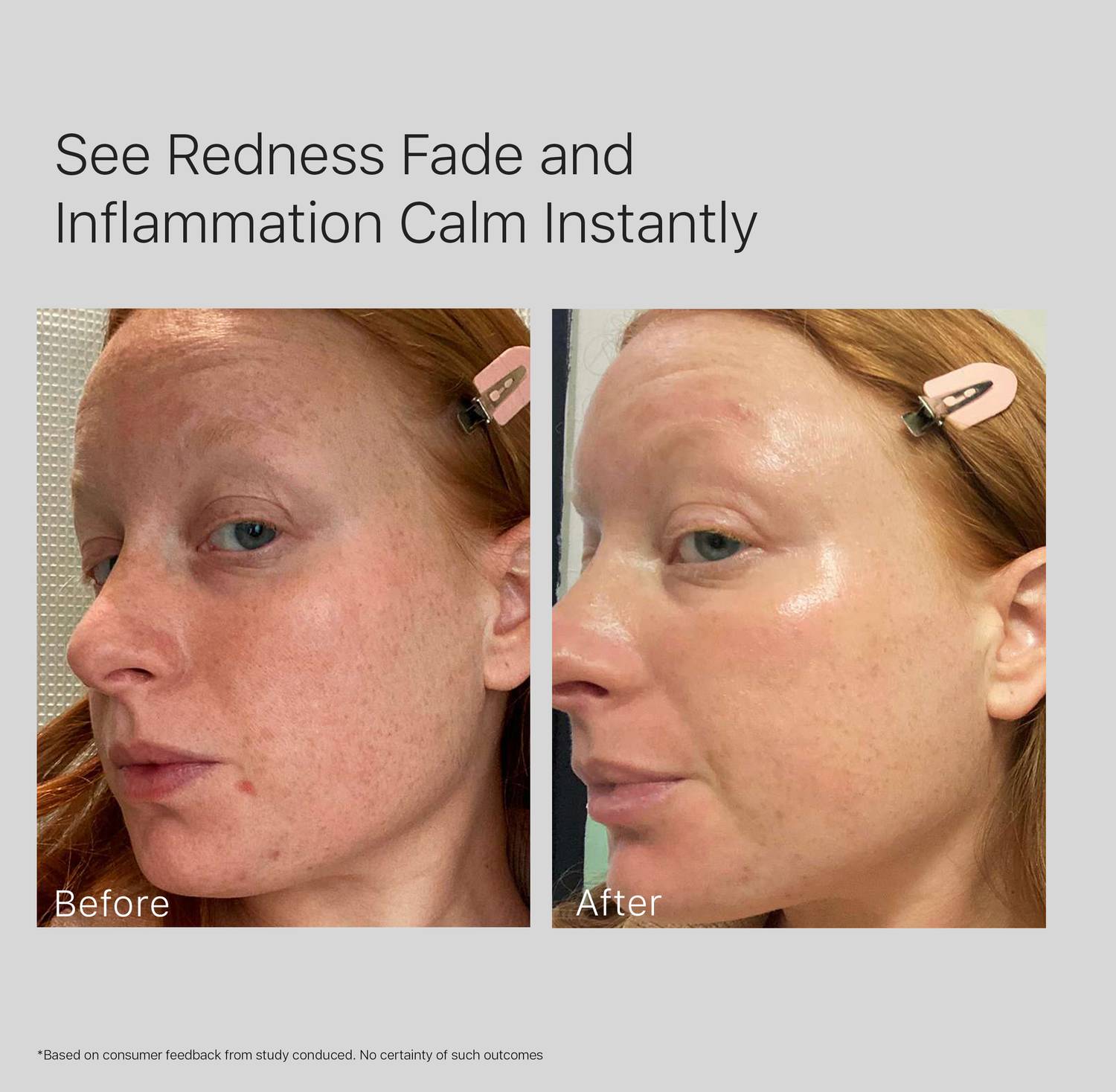Minomine Oil-Free Complete Skincare Combo - Image 2