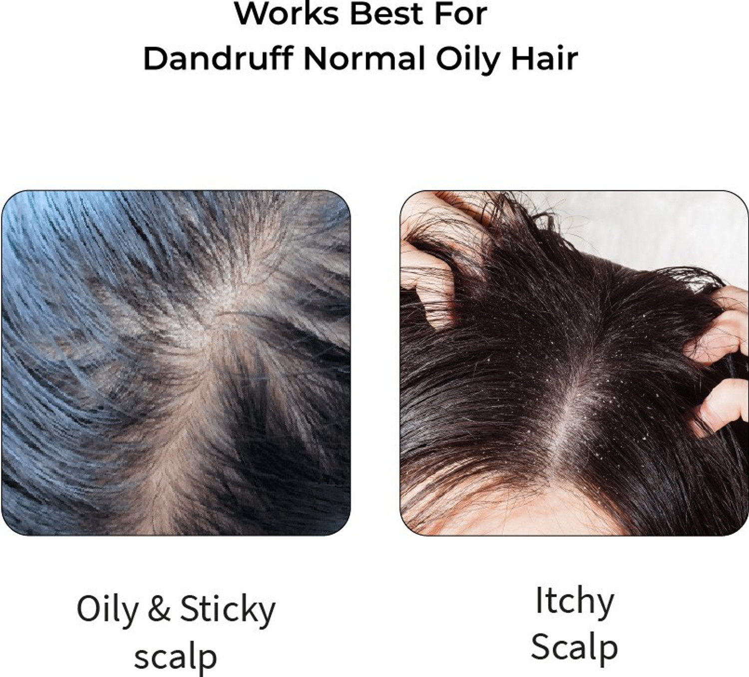 Image of Vedix Customised Hair Growth Combo|Hair Oil For Hair Fall|Anti Hair Fall Shampoo|Dandruff Normal -Oily Scalp|Curly -Wavy Hair,200ml