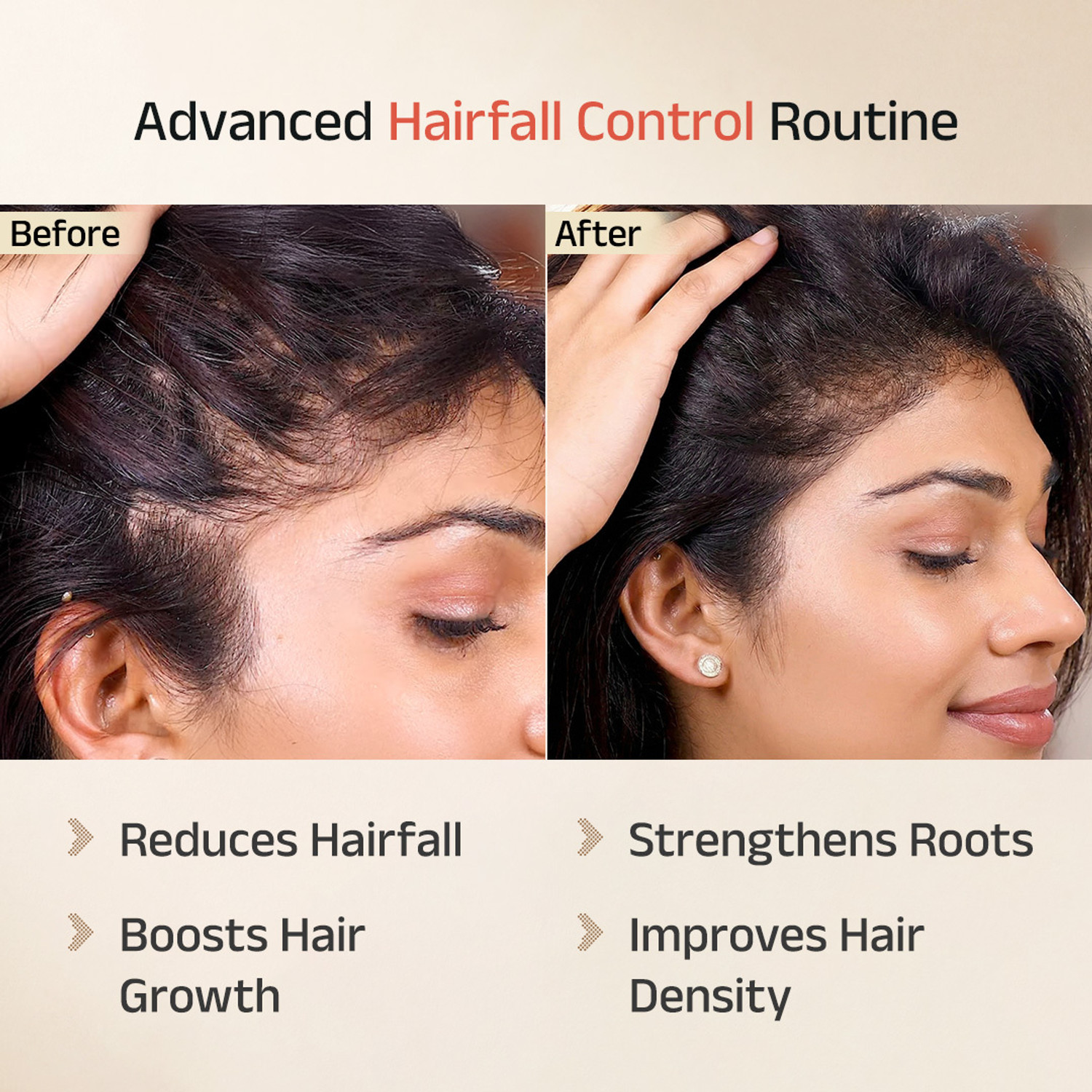 Image of Vedix Keshamrut Kit with Herbs Infused Oil, Hairfall Shampoo & Hair Growth Serum