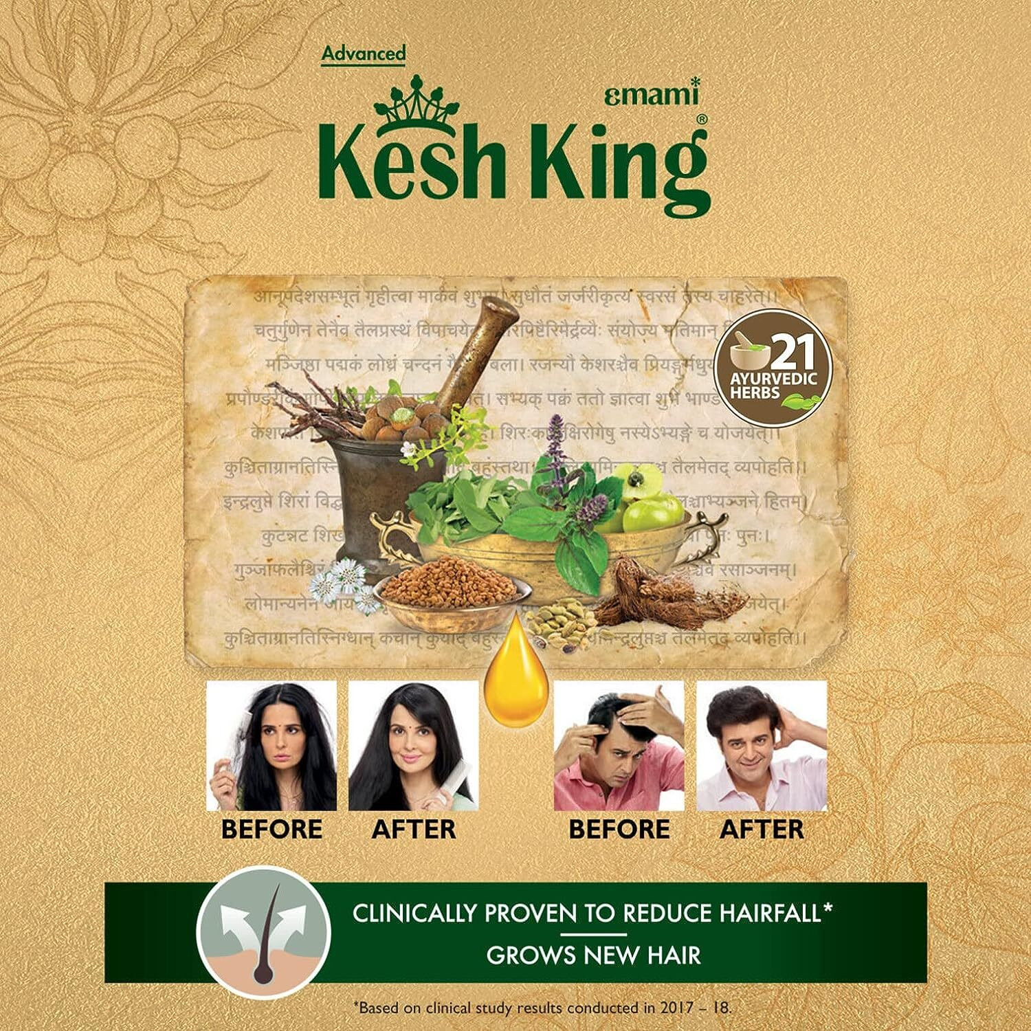 Image of Kesh King Ayurvedic Oil 300ml + Damage Repair Shampoo 340ml