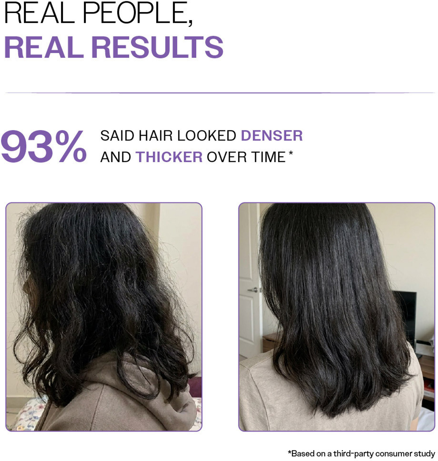 Image of BARE ANATOMY Rosemary Hair Growth Kit | Hair Spray, Shampoo, Conditioner,Oil & Scalp Massager