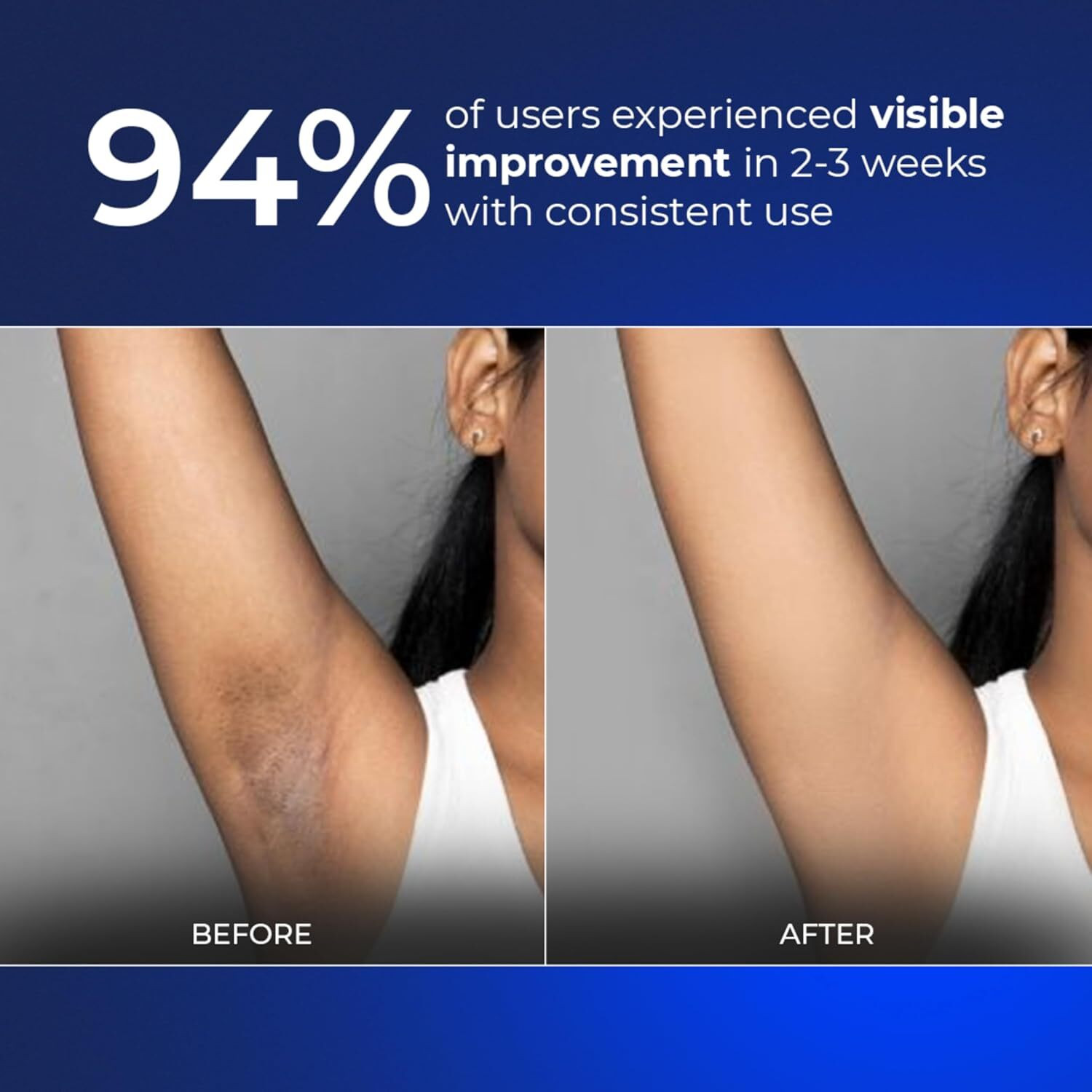 Image of Aqueria 5.5% AHA BHA Brightening Underarm Roll On | Fresh Fragrance Deodorant Roll-on - For Men & Women