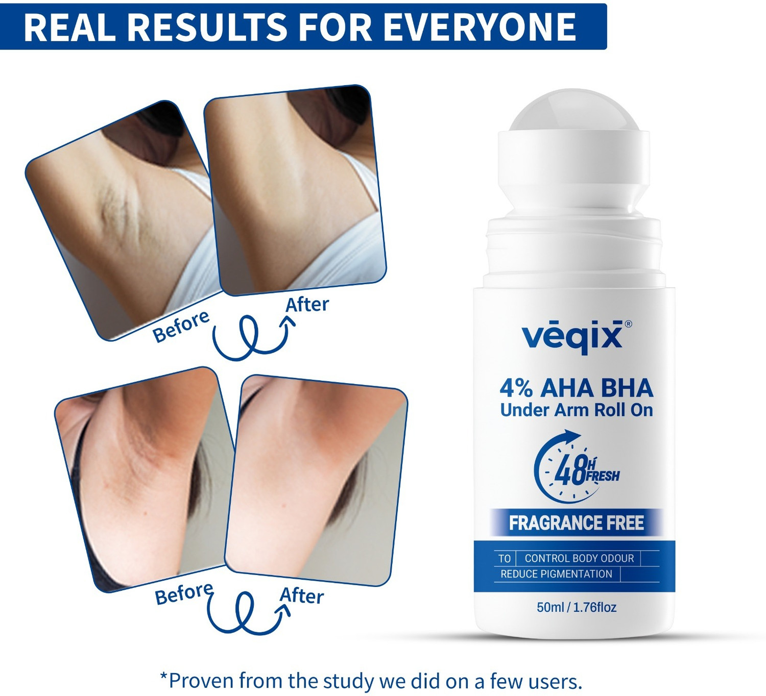 Image of veqix 4% AHA BHA | Reduces Pigmentation & Odour | Fragrance Free Underarm Deodorant Roll-on - For Women