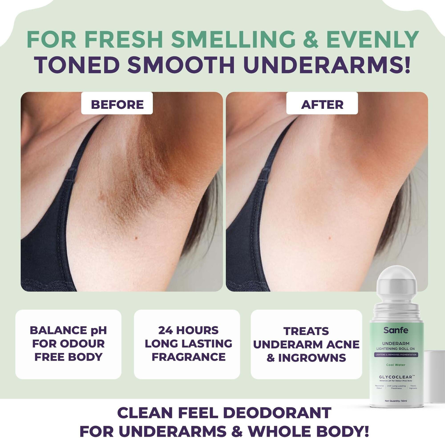 Image of Sanfe Underarm Lightening Roll On | Lightens & Removes Pigmentation | Treats ingrown Deodorant Roll-on - For Men & Women